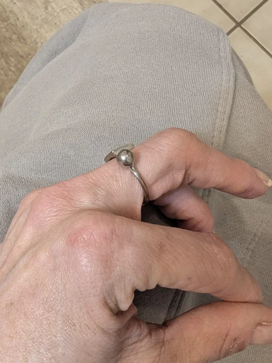 adjustable ring - Picture 4 of 8